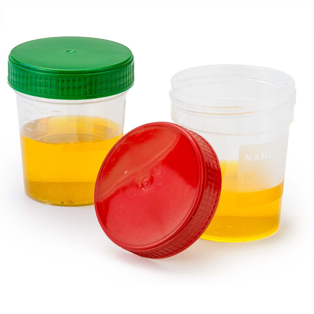 Globe Scientific Specimen Container, 4oz, with Full Turn Green Separate Screwcap, Frosted Writing Area, Non-Sterile, PP, Graduated Image